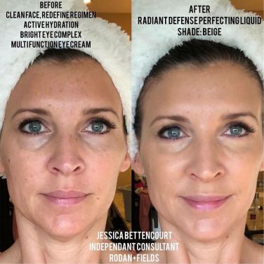 WHOA. Freebie Friday! This lady is one of my favorites. For many, many reasons. But, this picture is WHY you want to try our new Radiant Defense! Look at the difference! Do you want a flawless, natural finish? ð«Itâs NOT makeup! â­ï¸Itâs dermacosmetics. That means it is  SKINCARE that is dermatologically inspired. ð«It is GOOD for your skin! â­ï¸There is a SHADE match tool you can use right on your phone. ð« Iâm offering it HALF price today to ANYONE who  places a PC order (Itâs just a fancy word for a customer with benefits ð) with a regimen TODAY! Call me or message me for details! #flawless #skincare #notfoundation #glow #glowingskin #makeupfree #agingbackwards #allskintypes #rodanandfields #thereisroomforyou #skincareroutine #finalstepinyourskincareroutine #laststepinyourskincareroutine #moms #grandma #dermacosmetic #agebackwards #industrydisruptor